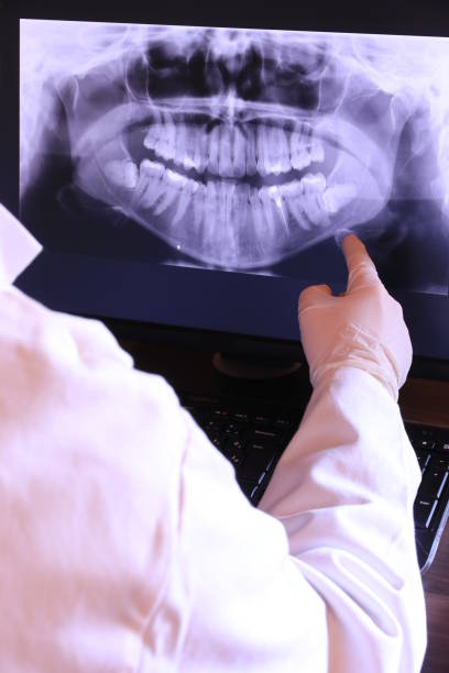 Best Emergency Dentist for Lost Fillings or Crowns in Thomasville, NC