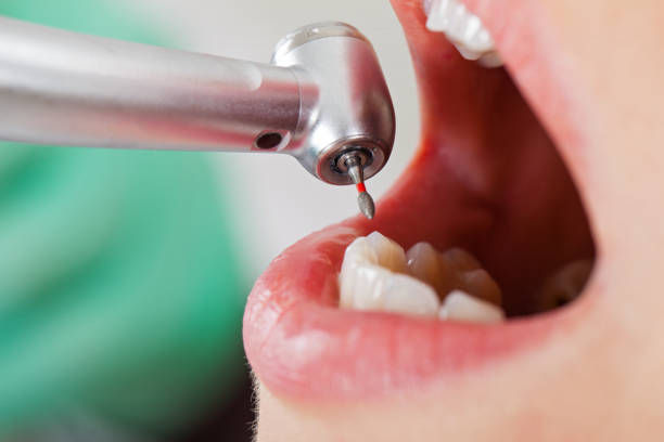Best Emergency Cosmetic Dentistry in Thomasville, NC